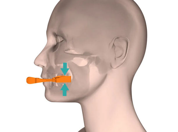 Rquilibrage postural (Articulation Temporo-Mandibulaire/ATM)  Dispositif  buccal (Ora) pour les douleurs articulaires, cervicales/dorsales,  lombaires, articulations  Rduction du bruxisme/des acouphnes et des  troubles de l'quilibre | Nature  Cur.